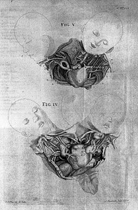 Opuscula sua anatomica, de respiratione, de monstris aliaque minora / recensuit, emendavid auxit aliaque inedita novasque icones addidit Albertus v. Haller.