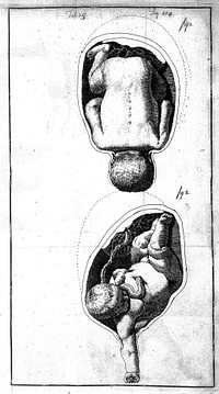 An essay towards a complete new system of midwifry, theoretical and practical. Together with the descriptions, causes and methods of removing, or relieving the disorders peculiar to pregnant ... women, and new-born infants / [John Burton].