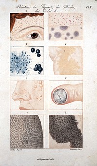 Traité théorique et pratique des maladies de la peau, fondé sur de nouvelles recherches d'anatomie et de physiologie pathologiques / Par P. Rayer.