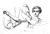 On bone-setting (so called), and its relation to the treatment of joints crippled by injury, rheumatism, inflammation, &c. &c / by Wharton P. Hood.