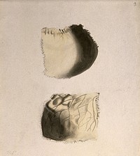 Bones of the skull: two figures. Ink and watercolour, after an unidentified work on anatomy, ca. 1830.