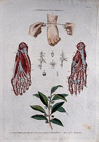 Top, surgery of the bones of the wrist; centre, arteries of the foot; bottom, the plant Ipecacuanha. Coloured engraving, 1834-1837.