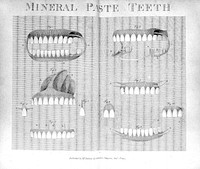 A dissertation on artificial teeth : evincing the advantages of teeth made of mineral paste, over every denomination of animal substance To which is added, advice to mothers and nurses on the prevention and cure of those diseases which attend the first dentition / By N. Dubois de Chémant.