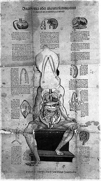Anatomical fugitive sheet, female; (Eve)