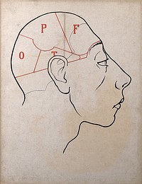 Right profile of head with depressed frontal lobes, divided up to show the location of all the lobes. Drawing, c. 1900.
