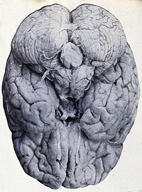 Friern Hospital, London: a brain. Photograph, 1890/1910.