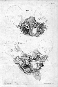 Opuscula sua anatomica, de respiratione, de monstris aliaque minora / recensuit, emendavid auxit aliaque inedita novasque icones addidit Albertus v. Haller.