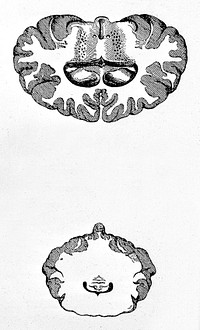 Sections of brain, sagittel and coronal.