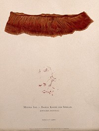 A stomach showing signs of cholera asiatica, with a detail below showing bacteria cells as seen under a microscope. Chromolithograph by W. Gummelt, ca. 1897.