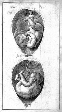 An essay towards a complete new system of midwifry, theoretical and practical. Together with the descriptions, causes and methods of removing, or relieving the disorders peculiar to pregnant ... women, and new-born infants / [John Burton].