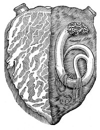 A worm found in the left ventricle