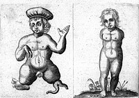 Licetus, De monstrorum caussis, natura, et differentiis libri duo ...1634