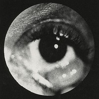 Clinical photograph of a cyst of conjunctiva. Original image from National Museum of Health and Medicine. Digitally enhanced by rawpixel.