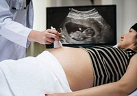 A trimester pregnant woman