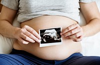 Pregnant woman showing fetus ultrasound photo