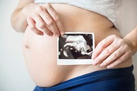 Pregnant woman showing fetus ultrasound photo