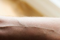 Closeup of a human arm and vein