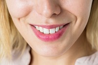 Closeup of smiling woman&#39;s teeth