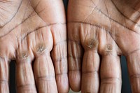 Closeup of calloused black hands
