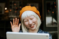Cut albino girl talking to her friends through a digital tablet