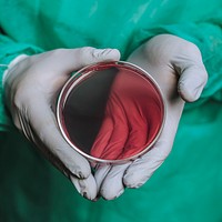 Doctor showing a blood agar plate
