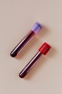 Blood test tubes in a beige background 