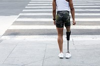 Woman with prosthetic standing by the crosswalk