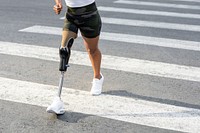 Woman with prosthetic leg crossing the road