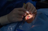 Dr. John Jarstead, an ophthalmologist from the University of Missouri, performs cataract surgery on a patient in an operating room aboard the hospital ship USNS Comfort (T-AH 20) at Esmeraldas, Ecuador, Oct. 25, 2018.