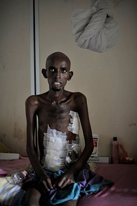 A patient sits in one of Madina Hospital's wards in Mogadishu, Somalia, on February 20. AU UN IST PHOTO / Tobin Jones. Original public domain image from <a href="https://www.flickr.com/photos/au_unistphotostream/12657761825/" target="_blank" rel="noopener noreferrer nofollow">Flickr</a>