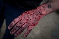 A civilian actor dressed in moulage to simulate an injury stands by to be placed at an accident site during a full scale exercise involving over 600 Army and Air National Guardsmen from New York, New Jersey, and West Virginia at Joint Base McGuire-Dix-Lakehurst, N.J., April 17, 2015.