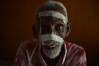 An elderly Somali man, thought to be suffering from cancer, sits on his bed at a ward in Barawe's hospital on August 23, 2016.