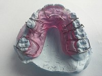 Orthodontic Retainers. Free public domain CC0 image.