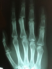 Xray scan of hand. Free public domain CC0 image.