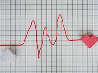 Heart Line Cardiogram Paper Graph