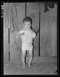 Child with rickets, son of relief client near Jefferson, Texas. This child has never talked though he is two years old. He has never received any medical attention by Russell Lee