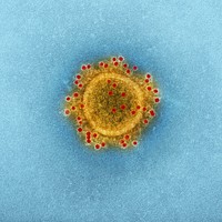 Transmission electron microscopic (TEM) image highlights the particle envelope of a single, spherical shaped, Middle East respiratory syndrome coronavirus (MERS-CoV) virion.