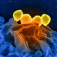 Group A Streptococcus (GAS), Streptococcus pyogenes bacteria, which were atop the surface of a human white blood cell (WBC), known as a neutrophil.