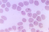 Photomicrograph of a human blood smear. Original image sourced from US Government department: Public Health Image Library, <a href="https://www.rawpixel.com/search/cdc?sort=curated&amp;page=1">Centers for Disease Control and Prevention</a>. Under US law this image is copyright free, please credit the government department whenever you can&rdquo;.