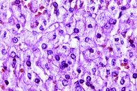 A 440X photomicrograph magnification of a hematoxylin and eosin (H&E)–stained liver tissue specimen, revealed the presence of cytoarchitectural changes indicative of fatty degeneration.