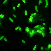 A 200X photomicrograph magnification of a direct fluorescent antibody (DFA) stained sample revealed the presence of rod shaped, Yersinia pestis bacteria.