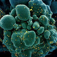 Novel Coronavirus SARS-CoV-2&ndash;Colorized scanning electron micrograph of an apoptotic cell (green) infected with SARS-COV-2 virus particles (yellow), isolated from a patient sample.