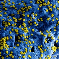 MERS Coronavirus Particles&ndash;Colorized scanning electron micrograph of Middle East Respiratory Syndrome virus particles attached to the surface of an infected VERO E6 cell. Original image sourced from US Government department: The National Institute of Allergy and Infectious Diseases. Under US law this image is copyright free, please credit the government department whenever you can&rdquo;.