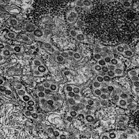 MERS Coronavirus Particles&ndash;Transmission electron micrograph of Middle East Respiratory Syndrome virusCoV particles found in the lumen of the endoplasmic reticulum in an infected MRC-5 cell.