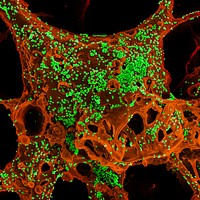 MERS Coronavirus Particles–Color-enhanced scanning electron micrograph of Vero E6 cells infected with Middle East respiratory syndrome coronavirus (MERS-CoV). Original image sourced from US Government department: The National Institute of Allergy and Infectious Diseases. Under US law this image is copyright free, please credit the government department whenever you can”.