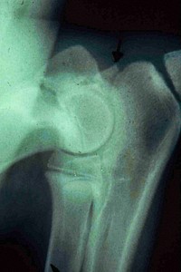 An x&ndash;ray of an ununited anconeal process (UAP) in a dog. UAP is a genetic disease of the canine elbow and commonly causes elbox dysplasia.