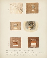 Human skin layers illustrated by Charles Dessalines D' Orbigny (1806-1876). Digitally enhanced from our own 1892 edition of Dictionnaire Universel D'histoire Naturelle.