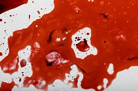 Infectious coronavirus blood splatter 