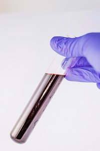 Free scientist running blood test image, public domain CC0 photo.