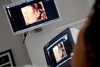 Free ultrasound at a hospital image, public domain CC0 photo.